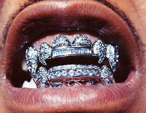 mes dents